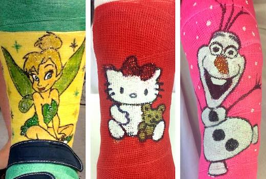 three casts with bright colorful paintings of hello kitty, tinkerbell, and the snowman from frozen