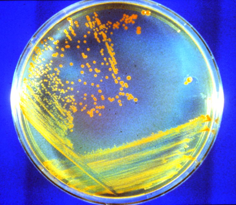 a microscope slide shows a sample of Conan the Bacterium